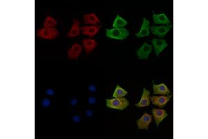 ABIN6262789 and ABIN6269097 staining HepG2 cells by IF/ICC. (KRT8 Antikörper  (C-Term))