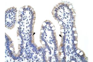 EXOSC10 antibody was used for immunohistochemistry at a concentration of 4-8 ug/ml to stain Epithelial cells of intestinal villus (arrows) in Human Intestine.