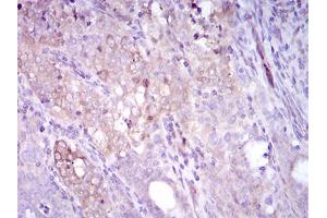 Immunohistochemistry (IHC) image for anti-Sequestosome 1 (SQSTM1) (AA 232-356) antibody (ABIN1724836)