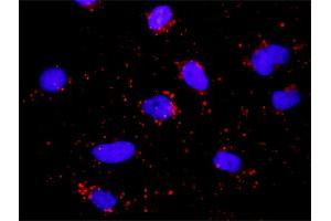 Proximity Ligation Assay (PLA) image for anti-Major Histocompatibility Complex, Class II, DQ alpha 1 (HLA-DQA1) (AA 24-110) antibody (ABIN516498)