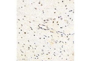 Immunohistochemistry of paraffin embedded mouse spinal cord using USP27 (ABIN7076113) at dilution of 1:700 (400x lens) (USP27X Antikörper)