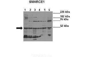 Lanes :  Lane 1: HeLa (human)Lane 2: NHEM (human)Lane 3: Melba (mouse)Lane 4: NIH3T3 (mouse)Lane 5: S16 (rat)Lane 6: H9C2 (rat)   Primary Antibody Dilution :   1:500    Secondary Antibody :  Donkey anti-rabbit-HRP   Secondary Antibody Dilution :   1:5000   Gene Name :  SMARCE1   Submitted by :  Ivana de la Serna, University of Toledo (SMARCE1 Antikörper  (N-Term))