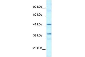 Western Blotting (WB) image for anti-TATA Box Binding Protein (TBP)-Associated Factor, RNA Polymerase I, A, 48kDa (TAF1A) (C-Term) antibody (ABIN2792590)