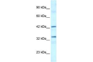 WB Suggested Anti-TAF1A Antibody Titration:  0.