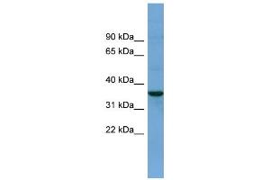 WB Suggested Anti-BACE2 Antibody Titration:  0.