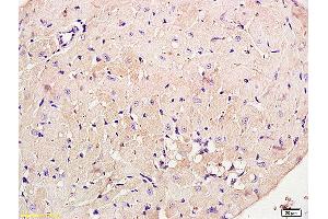 Formalin-fixed and paraffin embedded rat brain labeled with Anti phospho-PI3K p85/PIK3R1(Tyr368) Polyclonal Antibody, Unconjugated (ABIN711041) at 1:200 followed by conjugation to the secondary antibody and DAB staining (PIK3R1 Antikörper  (pTyr368))