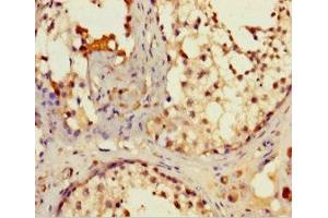 Immunohistochemistry of paraffin-embedded human testis tissue using ABIN7157004 at dilution of 1:100 (IFT80 Antikörper  (AA 1-268))