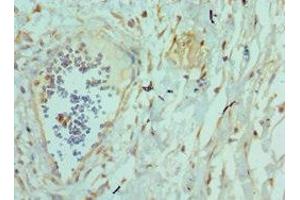 Immunohistochemistry (IHC) image for anti-Tumor Necrosis Factor (Ligand) Superfamily, Member 12 (TNFSF12) (AA 42-123) antibody (ABIN7173794)