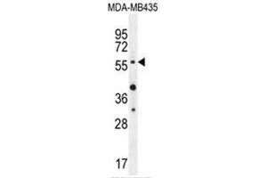 AKT1 (Thr308) Antibody western blot analysis in MDA-MB435 cell line lysates (35µg/lane). (AKT1 Antikörper  (AA 289-318))