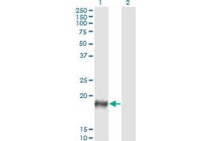 Western Blot analysis of PSCA expression in transfected 293T cell line by PSCA monoclonal antibody (M03), clone 5C2.