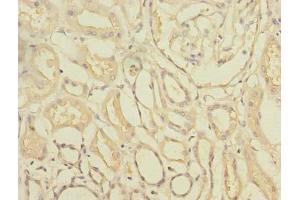 Immunohistochemistry of paraffin-embedded human kidney tissue using ABIN7171935 at dilution of 1:100 (TTC33 Antikörper  (AA 1-262))