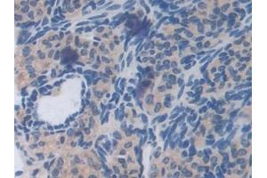 Immunohistochemistry (IHC) image for anti-Heparanase (HPSE) (AA 353-464) antibody (ABIN7438439)