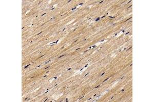 Immunohistochemistry analysis of paraffin embedded rat heart using KCNJ5 (ABIN7075152) at dilution of 1: 800