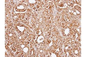 IHC-P Image Immunohistochemical analysis of paraffin-embedded NCI-N87 xenograft, using RPL13A, antibody at 1:100 dilution. (RPL13A Antikörper)