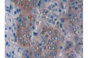 IHC-P analysis of Rat Adrenal gland Tissue, with DAB staining. (CPT1A Antikörper  (AA 572-773))