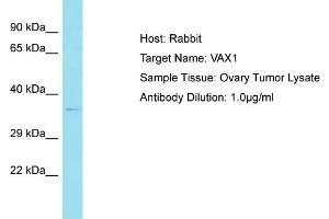 Host: Rabbit Target Name: VAX1 Sample Tissue: Human Ovary Tumor Antibody Dilution: 1ug/ml (VAX1 Antikörper  (N-Term))