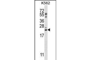 PSORS1C1 Antibody (N-term) (ABIN657118 and ABIN2846264) western blot analysis in K562 cell line lysates (35 μg/lane). (PSORS1C1 Antikörper  (N-Term))