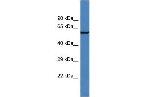 Western Blotting (WB) image for anti-Adhesion Molecule with Ig-Like Domain 2 (AMIGO2) (N-Term) antibody (ABIN2786380) (AMIGO2 Antikörper  (N-Term))