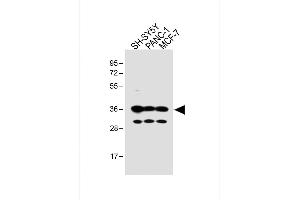 All lanes : Anti-OR5V1 Antibody (C-term) at 1:1000 dilution Lane 1: SH-SY5Y whole cell lysate Lane 2: NC-1 whole cell lysate Lane 3: MCF-7 whole cell lysate Lysates/proteins at 20 μg per lane. (OR5V1 Antikörper  (C-Term))