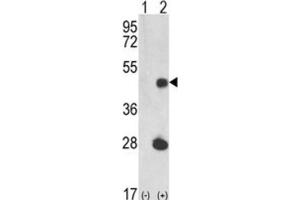 Western Blotting (WB) image for anti-LUC7-Like (LUC7L) antibody (ABIN3002860) (LUC7L Antikörper)