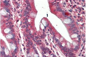 ABIN625816 (5µg/ml) staining of paraffin embedded Human Small Intestine. (SH3GL1 Antikörper  (Internal Region))