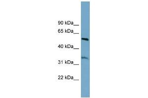WB Suggested Anti-THNSL2 Antibody Titration: 0. (THNSL2 Antikörper  (Middle Region))