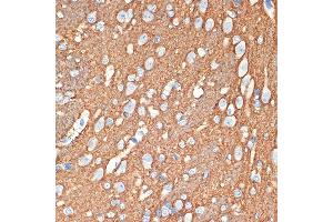 Immunohistochemistry (IHC) image for anti-Syntaxin 1B (STX1B) antibody (ABIN7270685)
