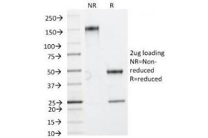 SDS-PAGE Analysis of Purified, BSA-Free HSP27 Antibody (clone HSPB1/774). (HSP27 Antikörper)