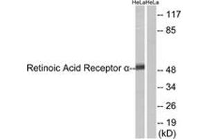 Western blot analysis of extracts from HeLa cells, using Retinoic Acid Receptor alpha (Ab-77) Antibody. (Retinoic Acid Receptor alpha Antikörper  (AA 46-95))