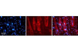 Rabbit Anti-SIRT5 Antibody    Formalin Fixed Paraffin Embedded Tissue: Human Adult heart  Observed Staining: Cytoplasmic Primary Antibody Concentration: 1:600 Secondary Antibody: Donkey anti-Rabbit-Cy2/3 Secondary Antibody Concentration: 1:200 Magnification: 20X Exposure Time: 0. (SIRT5 Antikörper  (Middle Region))