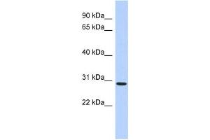 Western Blotting (WB) image for anti-SERTA Domain Containing 2 (SERTAD2) antibody (ABIN2459489) (SERTAD2 Antikörper)