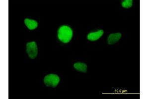 Immunofluorescence of purified MaxPab antibody to ZFP161 on HeLa cell. (ZBTB14/ZFP161 Antikörper  (AA 1-449))