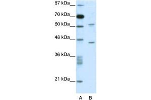 WB Suggested Anti-C1ORF25 Antibody Titration: 0. (TRMT1L Antikörper  (N-Term))