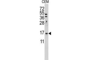 Western Blotting (WB) image for anti-LSM1 Homolog, U6 Small Nuclear RNA Associated (LSM1) antibody (ABIN3001679) (LSM1 Antikörper)
