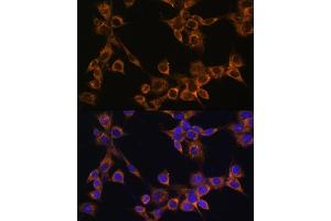 Immunofluorescence analysis of NIH/3T3 cells using R antibody (ABIN6132582, ABIN6146672, ABIN6146673 and ABIN6222096) at dilution of 1:100. (RAMP1 Antikörper  (AA 27-117))