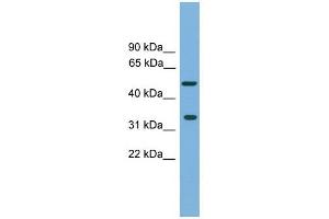 CFDP1 antibody used at 1 ug/ml to detect target protein. (CFDP1 Antikörper  (Middle Region))