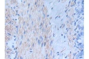 Detection of INHbA in Rat Intestine Tissue using Monoclonal Antibody to Inhibin Beta A (INHbA) (INHBA Antikörper  (AA 314-424))