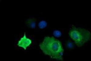 Image no. 2 for anti-Cancer/testis Antigen 1B (CTAG1B) antibody (ABIN1499901) (CTAG1B Antikörper)