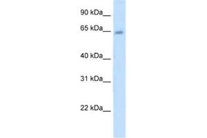 Western Blotting (WB) image for anti-Steroid Sulfatase (Microsomal), Isozyme S (STS) antibody (ABIN2462461) (STS Antikörper)
