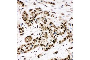 Immunohistochemistry (IHC) image for anti-X-Ray Repair Complementing Defective Repair in Chinese Hamster Cells 5 (Double-Strand-Break Rejoining) (XRCC5) (AA 648-662), (C-Term) antibody (ABIN3044235)
