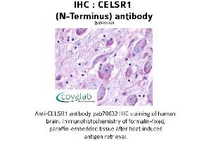 Image no. 1 for anti-Cadherin EGF LAG Seven Pass G-Type Receptor 1 (CELSR1) (Extracellular Domain), (N-Term) antibody (ABIN1732966)
