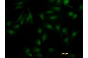 Immunofluorescence of monoclonal antibody to NR1H2 on HeLa cell.