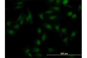 Immunofluorescence of monoclonal antibody to NR1H2 on HeLa cell. (NR1H2 Antikörper  (AA 1-461))