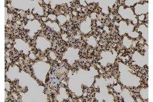 ABIN6279878 at 1/100 staining Mouse lung tissue by IHC-P.