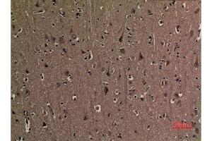 Immunohistochemistry (IHC) analysis of paraffin-embedded Human Brain, antibody was diluted at 1:100. (p53 Antikörper  (2meLys370))