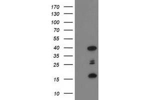 Western Blotting (WB) image for anti-PDZ and LIM Domain 2 (PDLIM2) antibody (ABIN1500124) (PDLIM2 Antikörper)