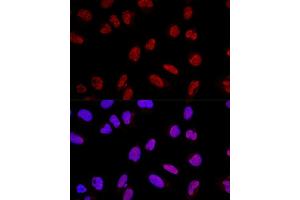 Confocal immunofluorescence analysis of U2OS cells using  Polyclonal Antibody (ABIN3017254, ABIN3017255, ABIN3017256 and ABIN6220015) at dilution of 1:200. (AKAP8 Antikörper  (AA 480-692))