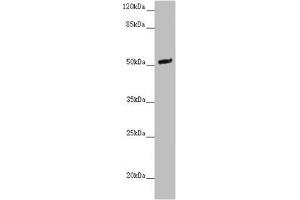 Western blot All lanes: NOXA1 antibody at 2 μg/mL + Mouse brain tissue Secondary Goat polyclonal to rabbit IgG at 1/10000 dilution Predicted band size: 51, 52, 46 kDa Observed band size: 51 kDa (NOXA1 Antikörper  (AA 150-313))