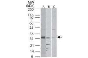 Western blot analysis of RTN4R in A) human, B) mouse and C) rat brain tissue lysate.