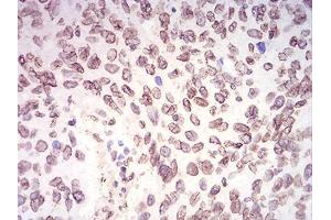 Immunohistochemistry (IHC) image for anti-Lamin B2 (LMNB2) (AA 401-600) antibody (ABIN5870700) (Lamin B2 Antikörper  (AA 401-600))